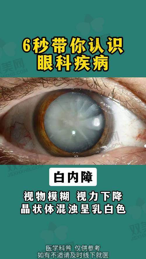 【石家庄联谊眼科医院擅长什么项目】