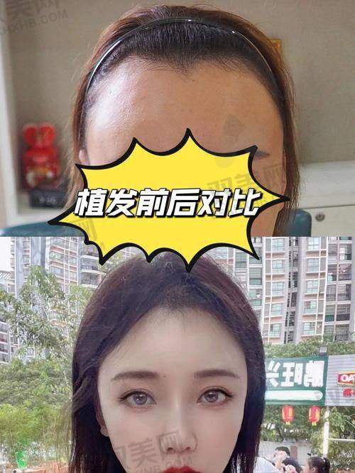 【西安科大植发医院怎么预约挂号】