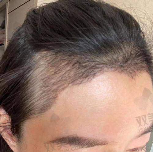 【西安科大植发医院营业时间是什么时候】