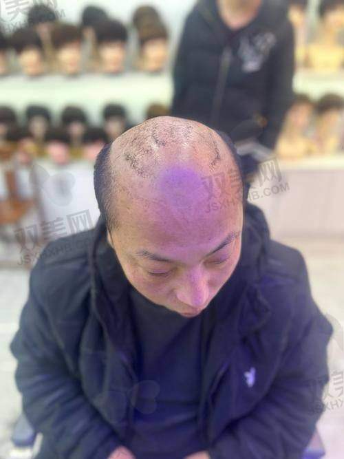 西安锐逸植发医院