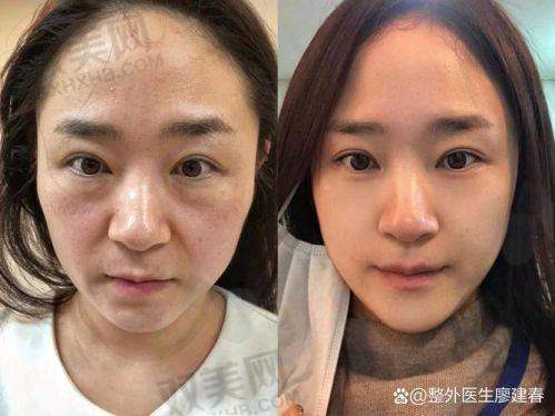 它的成效靠谱吗？对比图 + 使用感全网首曝！