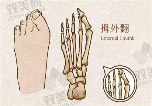 如何选择正规的润致玻尿酸产品