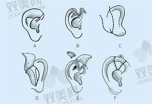 医生团队与价格因素深度剖析