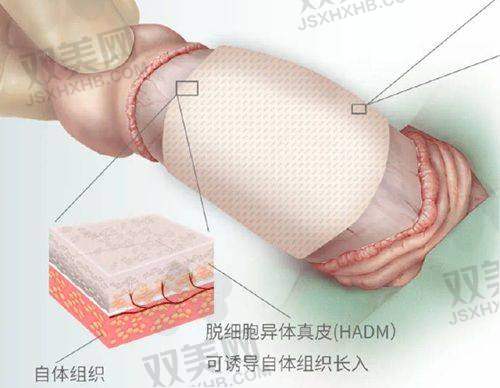 北京嘉禾整形医院私密整形的综合优势及价格背后的价值