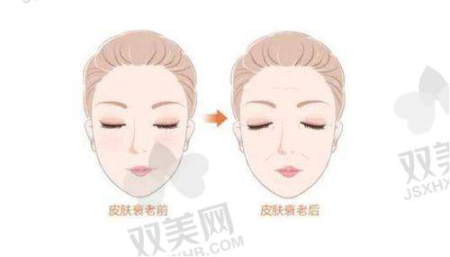 总结