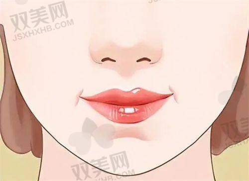 手术过程和感受