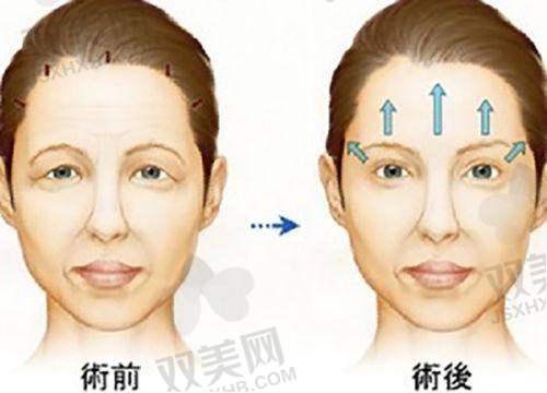总结与询问引导