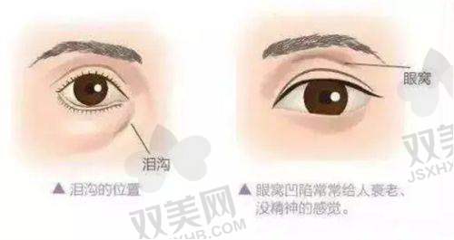 填充成效能保持多久