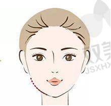 三、玻尿酸能保持多久