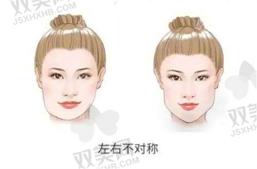 术前准备