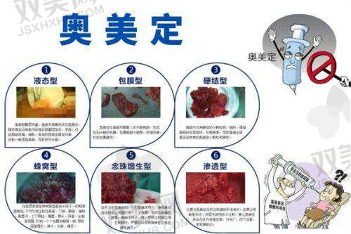 四、成效惊艳，价格大揭秘