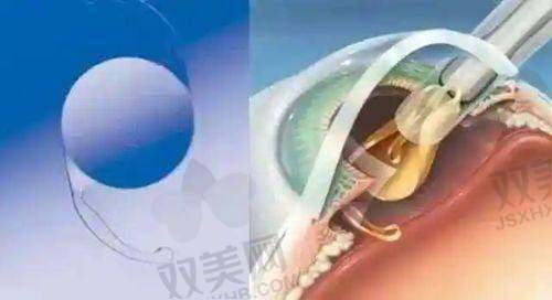 悦白之几在医美市场的发展前景