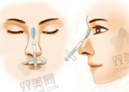 术后修复与注意事项