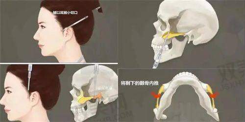 打针过程：紧张又期待