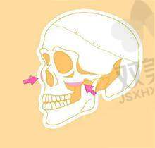 术后成效及感受
