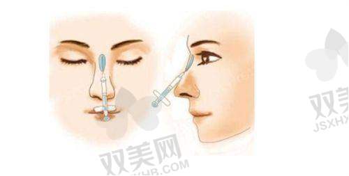 费用情况