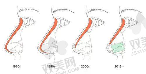 我亲测面部填充整形，揭秘一次要多少钱、全脸填充费用及价位情况！