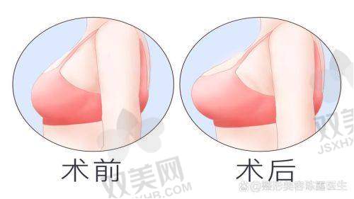 六、美波婷适合哪些人？不只是平胸妹妹才配拥有！