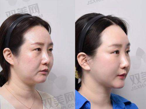 【湛江韩逅医疗美容门诊部是正规的吗】