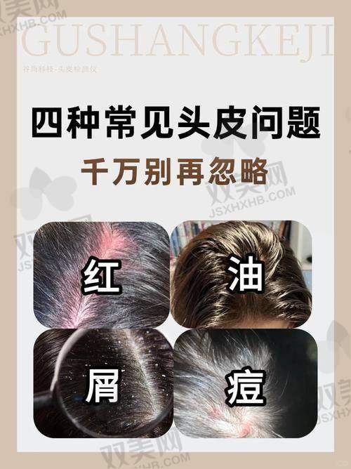 【东莞台心医院植发科怎么样】
