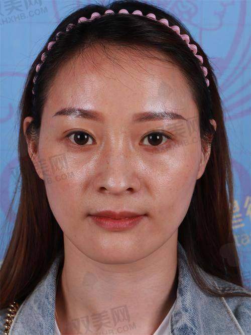【江门梦想医疗美容医院电话号码是多少】