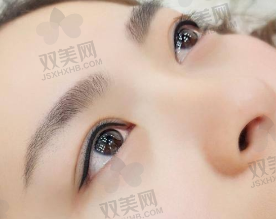 面诊与方案确定