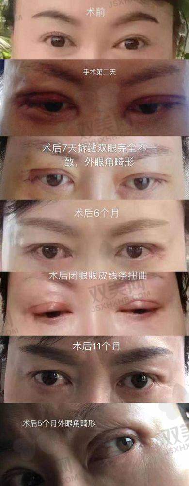 【惠州天成医疗美容医院擅长什么项目】