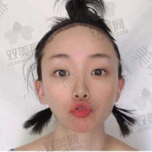 【东莞青逸植发医院是正规的吗】