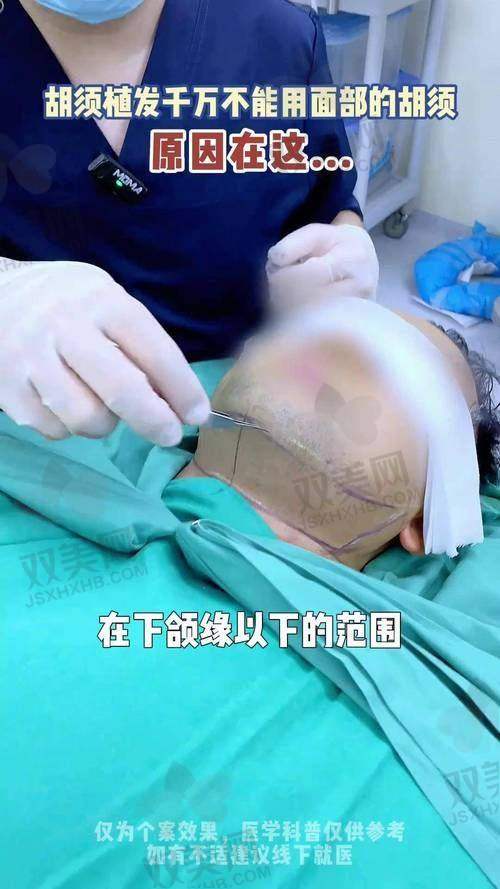 【东莞科生植发医院是私立还是公办】