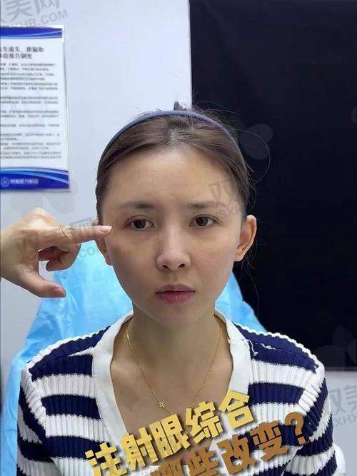 广州米伦整形医院到底靠谱吗？别急，咱们一点点来说