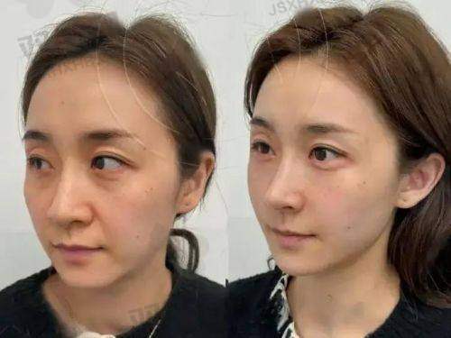 【济南美途医疗美容医院是正规的吗】