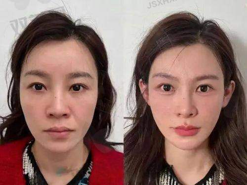 【东莞熹熹医疗美容医院怎么预约挂号】