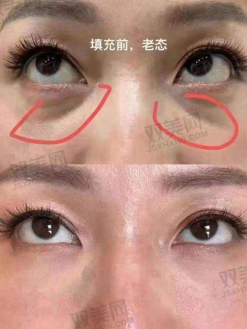 面诊与注射过程