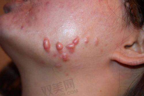 踏上修复之路