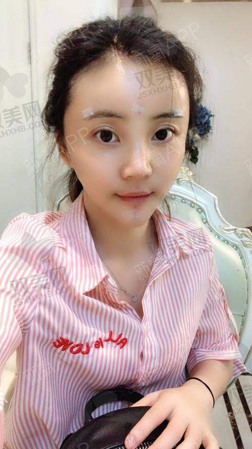 脸部填充与其他医美项目的搭配