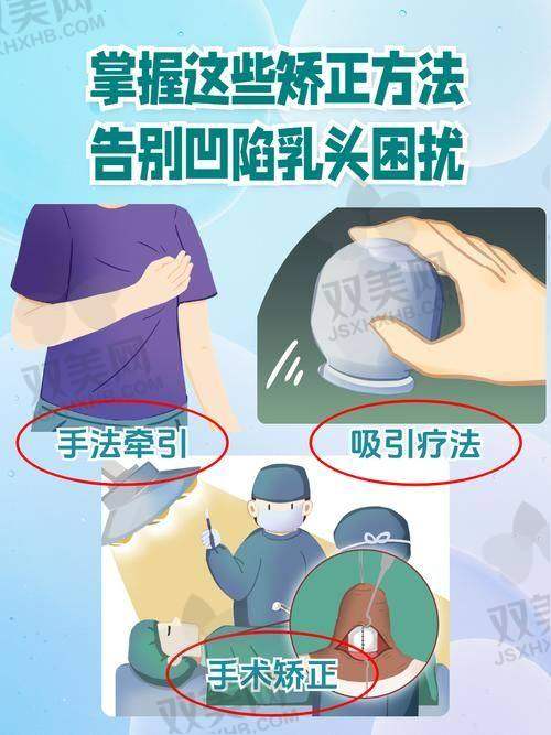 手术所需手续说明