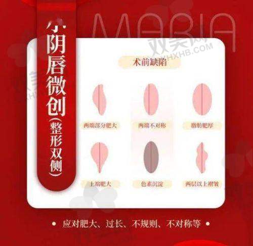 八爪鱼阴道紧缩术和普通紧缩术的风险