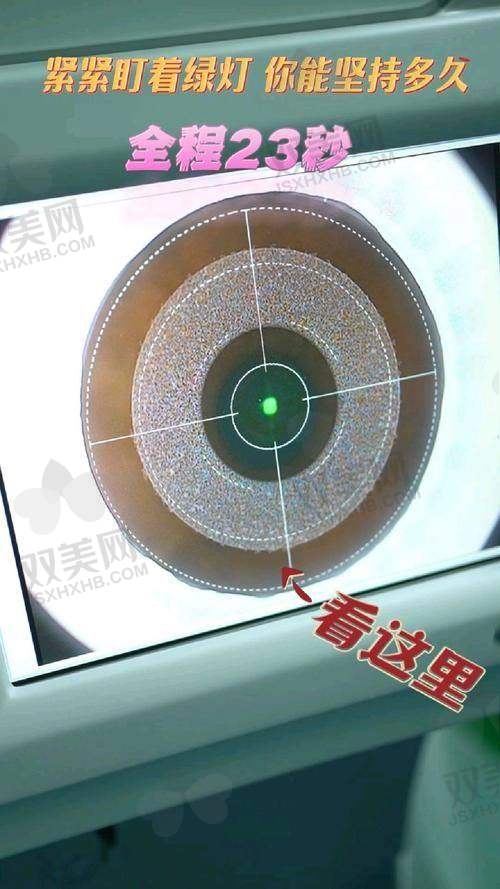 第一次割双眼皮都没有这详细的说明书，全飞秒价格明细直接扒给你！