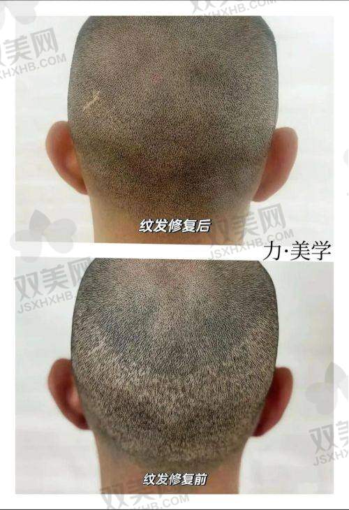 使用i黑密生发头盔有哪些注意事项
