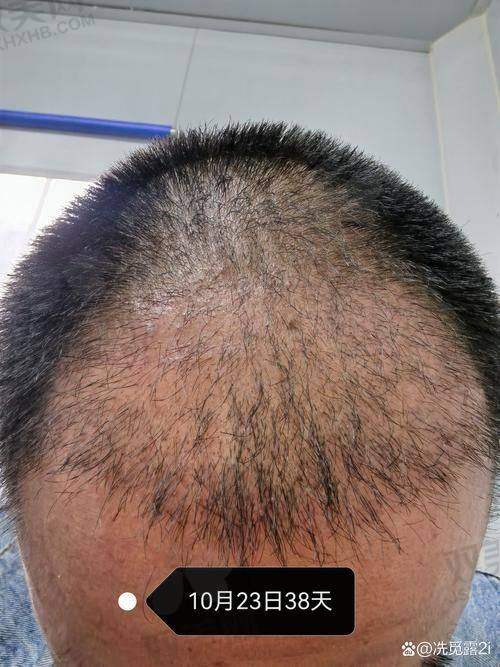 i黑密生发头盔的用户评价如何
