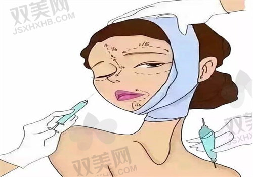 我做法令纹手术花了3.5万，揭秘手术怎么做、风险大不大，以及能维持多久！