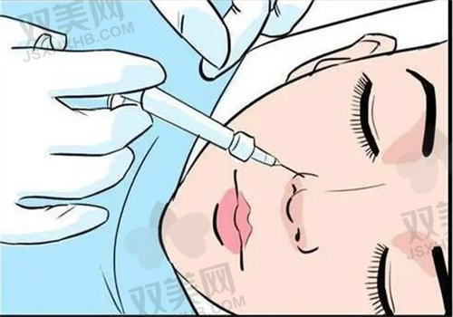 我用玻尿酸填充下巴啦！分享多久变软自然、需几支及能维持多久的体验