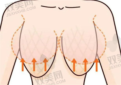 殷初阳做手术好吗？隆胸技术、价格、案例全解析，助你选对医生！