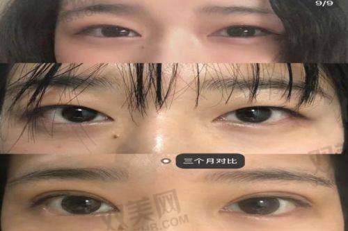 技术、硬件、审美到位，刘志刚靠的这股“妈生审美修复流”成顶流医生