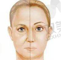 动物组织提取