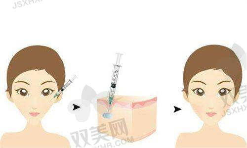 鲜红斑痣治疗的新技术