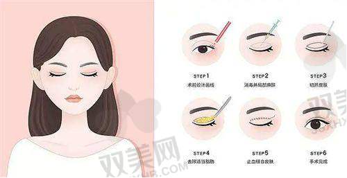 如何选择适合自己的填充材料？