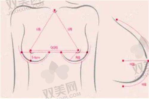 奥美定隆胸取出修复哪家医院做的好？国内这 16 家医院技术优、价格美！