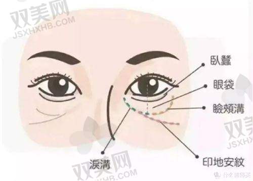 北京鼻子打玻尿酸价格情况