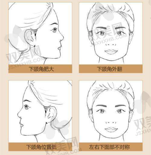 如何判断玻尿酸价格是否合理